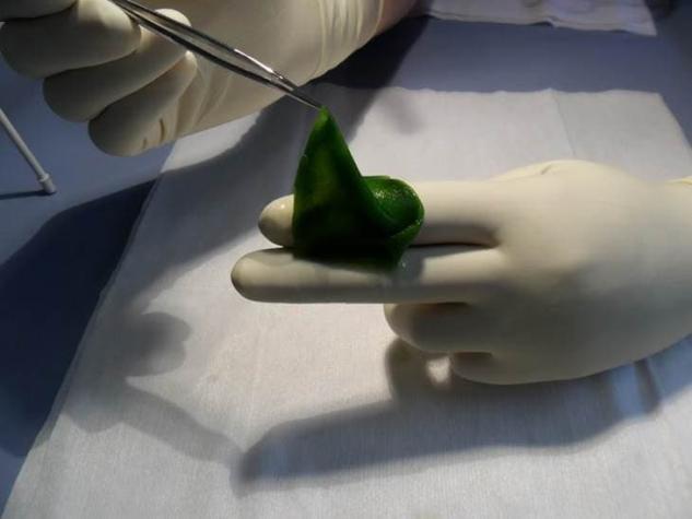 HULK: La piel "fotosintética" que regenera tejidos creada por científicos chilenos