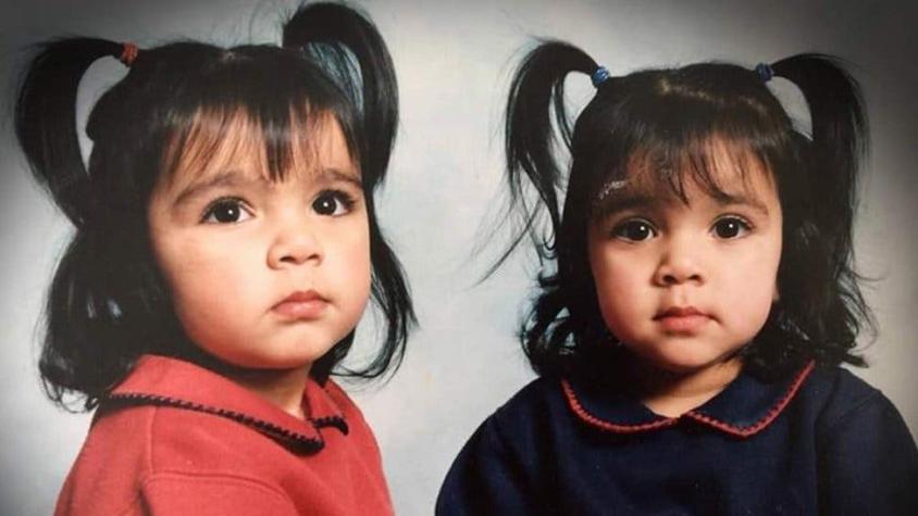 La conmovedora historia de dos gemelas cuya vida cambió por un terrible accidente