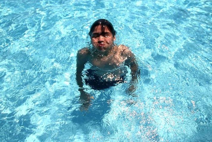 28 niños de tercero básico quedaron con lesiones por exceso de cloro en piscina