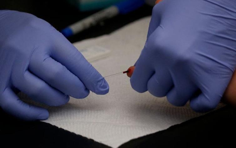 Test rápido de VIH: Todos los lugares donde hacerse la prueba región por región