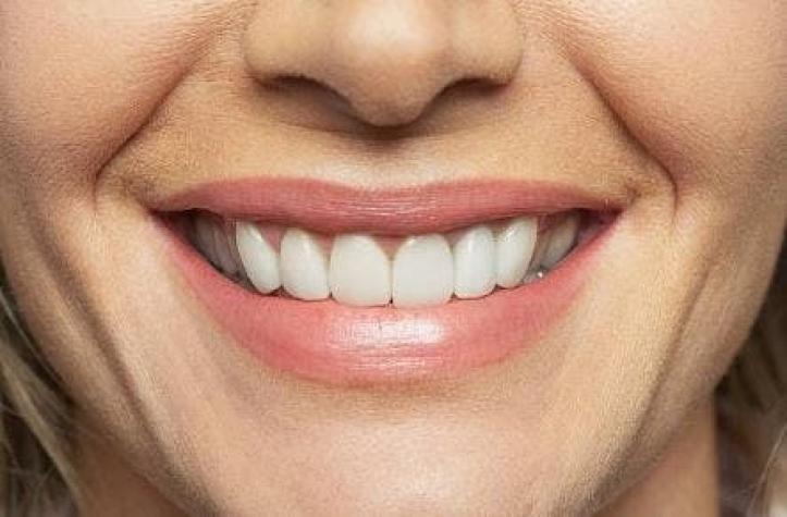 ¿Sonrisa perfecta? Experto informa sobre beneficios de los implantes dentales