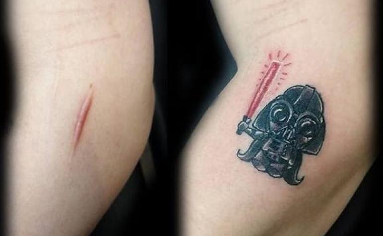 [FOTOS] Geniales y hermosos tatuajes para disimular cicatrices y marcas de nacimiento