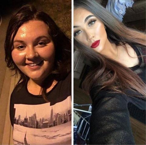 [FOTOS] Mujer bajó más de 80 kilos tras superar su adicción a la comida chatarra