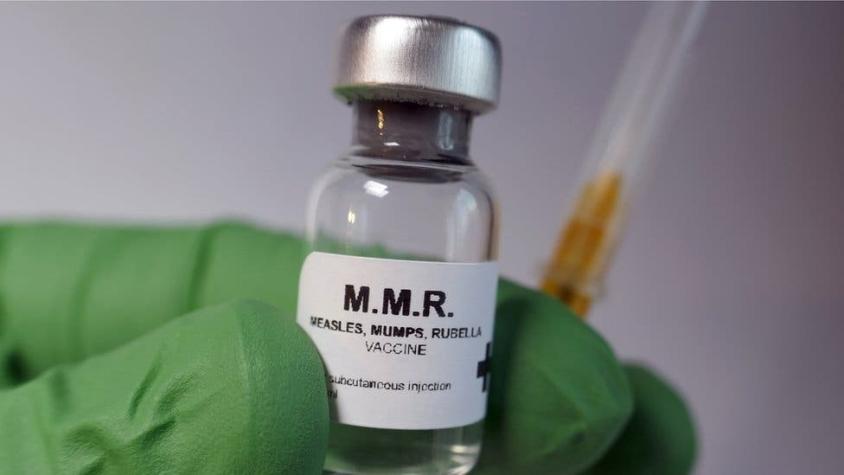 Sarampión: 8 mitos sobre las vacunas que pueden explicar los nuevos brotes de la enfermedad