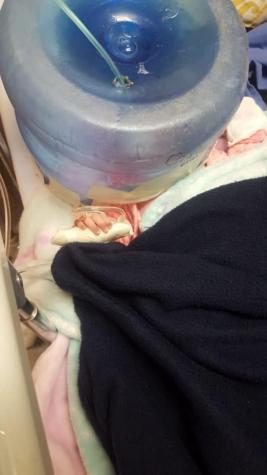[FOTOS] Mujer denuncia que usaron bidón de agua como máscara de oxigeno para recién nacida