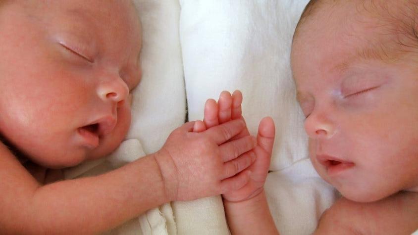 El caso de gemelos semidénticos que suelen ser "incompatibles con la vida" e intrigan a científicos
