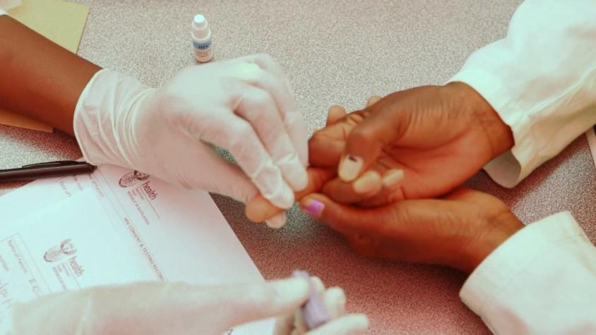[VIDEO] Científicos hacen "desaparecer" VIH de paciente