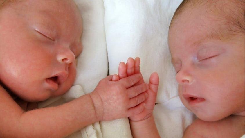 El extraño caso de la bebé que nació "embarazada" con su hermano gemelo