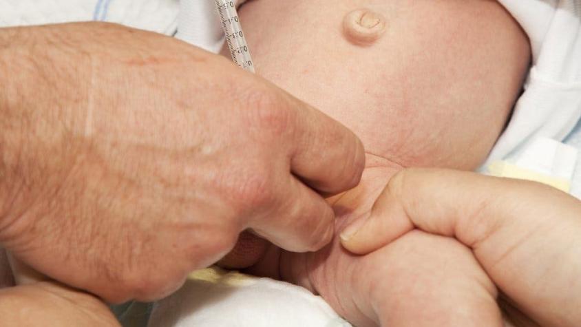 Bebé de cinco meses muere por circuncisión casera en Italia