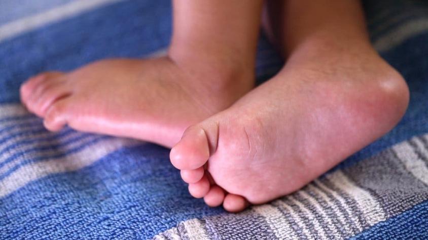 Una mujer da a luz a gemelos 26 días después de tener su primer hijo