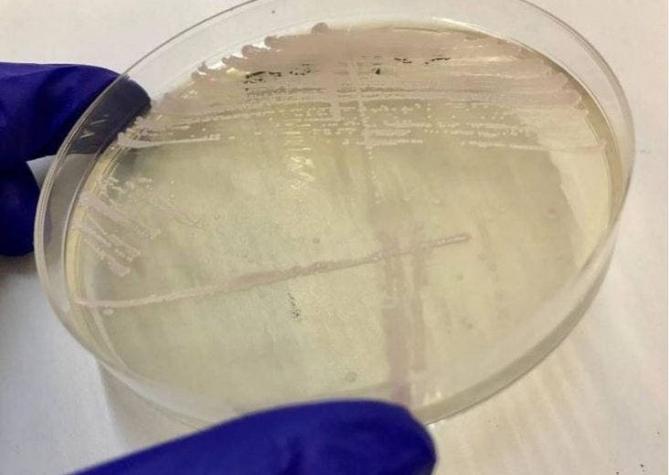 Reportan primer caso en Chile de Candida Auris, el peligroso hongo resistente a tratamientos
