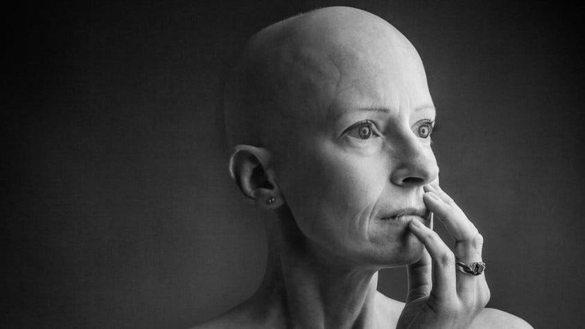 "Como muchas mujeres, no me revisé los senos": la cirujana que operaba cáncer de mama y tuvo cáncer