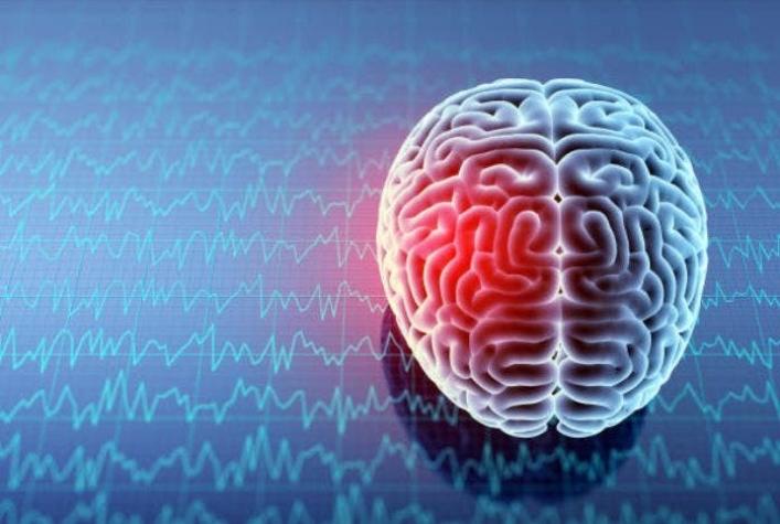 El implante que le permitirá "hablar" a pacientes con daño cerebral