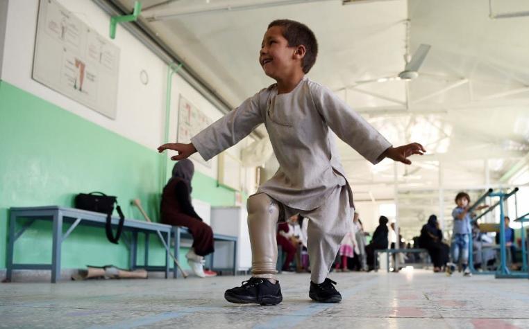[VIDEO] ¡Emocionante! Niño afgano baila feliz para agradecer su nueva prótesis de pierna