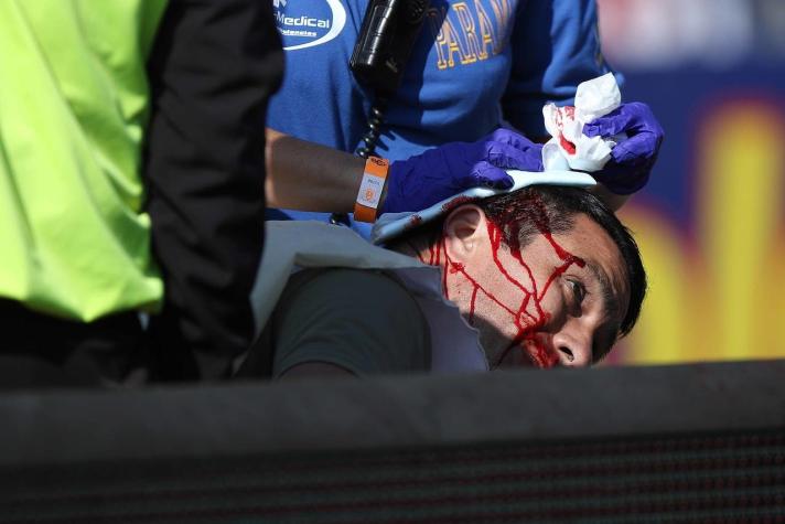 [FOTOS] Reportero gráfico tuvo que recibir atención médica tras ser agredido en pleno Superclásico