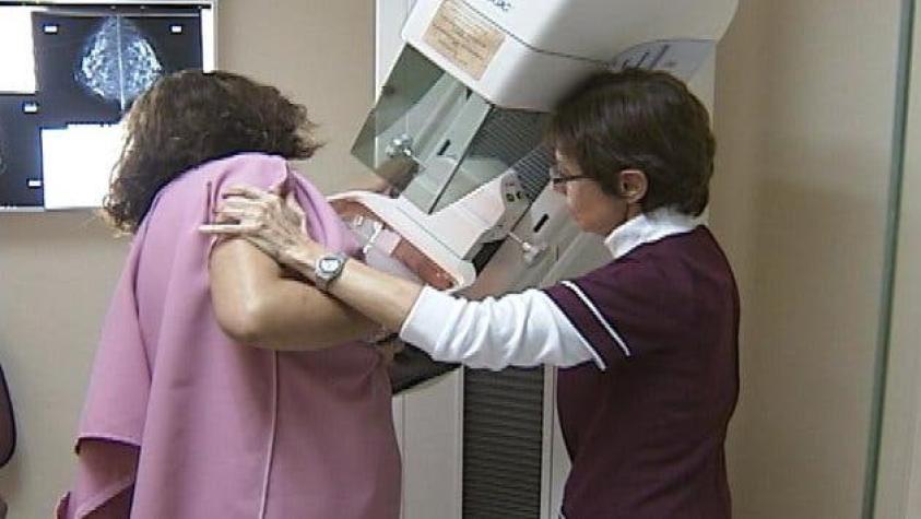 Inteligencia artificial permite detectar el cáncer de mama con hasta cinco años de anticipación