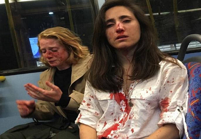 Pareja de mujeres denuncia brutal ataque lesbofóbico en Londres
