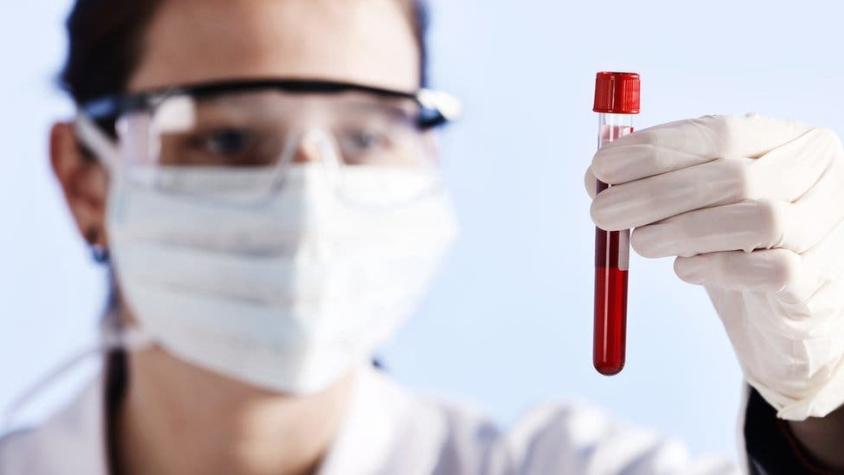 El "prometedor" logro de los científicos que convirtieron sangre A y B en el tipo universal O
