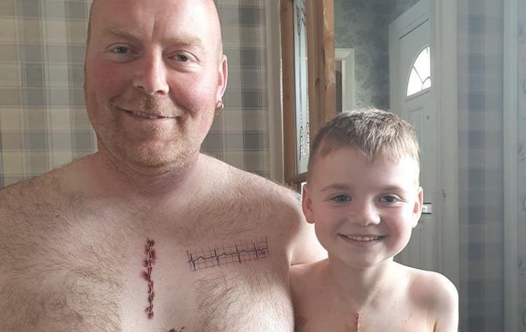 "Debe estar orgulloso": Papá se tatúa en el pecho cicatriz de su hijo tras ser operado del corazón