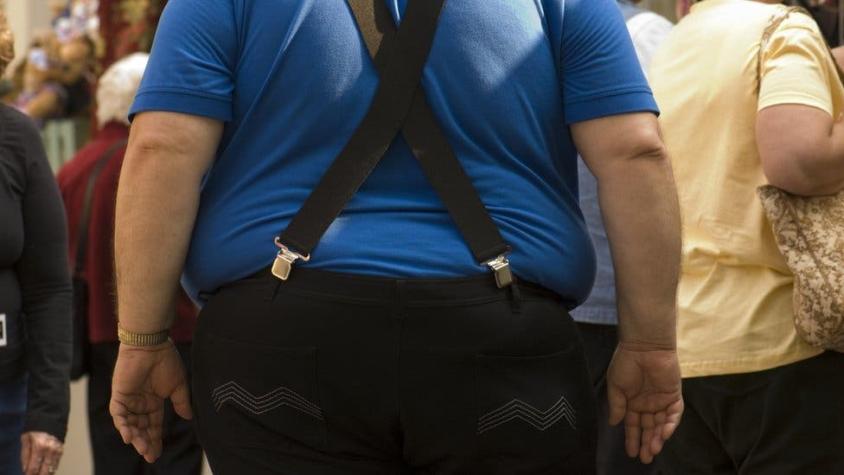 Obesidad: los 4 tipos de cáncer cuya principal causa es el sobrepeso