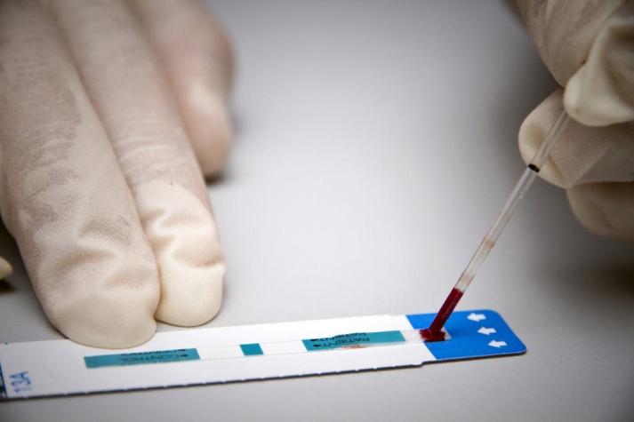 Increíble avance: Científicos logran eliminar el VIH de ratones vivos