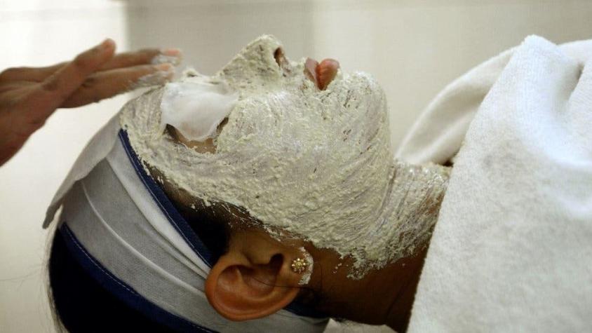 Blanqueamiento de la piel: por qué millones de mujeres siguen sometiéndose a peligrosos tratamientos