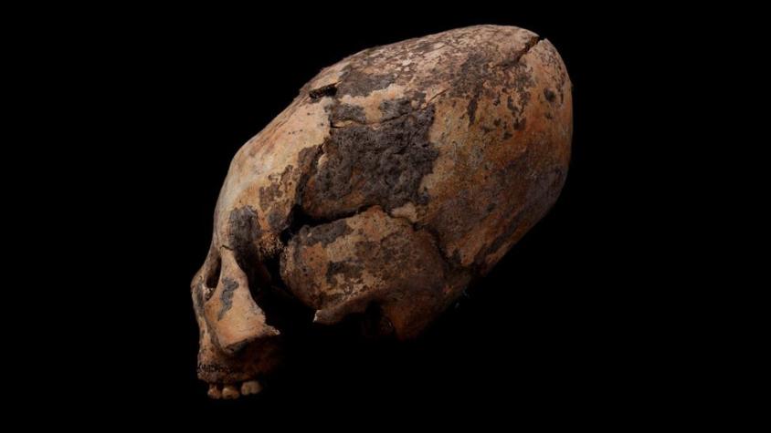 Los impresionantes cráneos humanos deformados intencionalmente hace 12.000 años