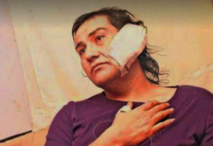 Movilh denuncia ataque con machete contra mujer trans: Sufrió cortes en su cara, cabeza y oreja
