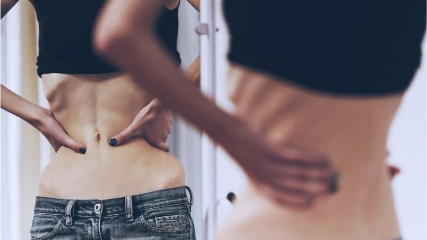 El descubrimiento de que la anorexia no es sólo un desorden psiquiátrico
