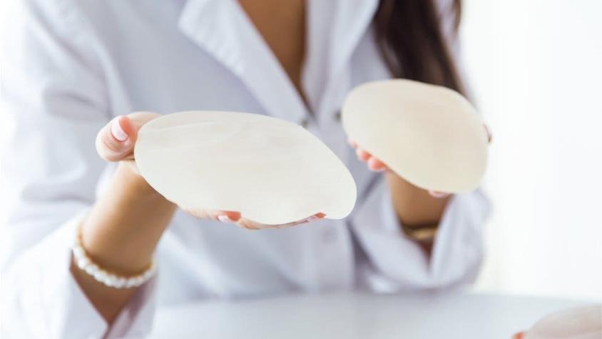La enfermedad por implantes mamarios que no tienen base científica pero que sufren miles de mujeres
