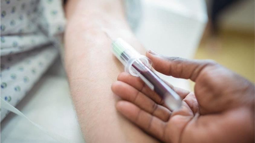 El análisis de sangre que permite detectar el alzhéimer hasta 20 años antes de que se manifieste