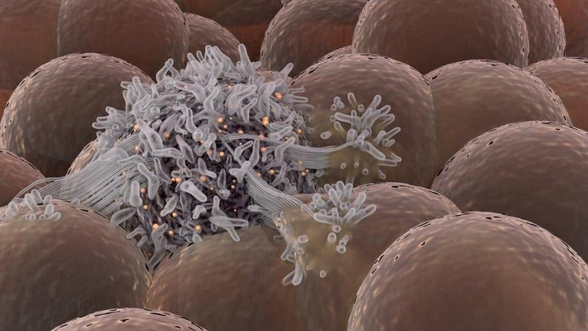 Cómo unas células sordas y manipuladoras originan el cáncer