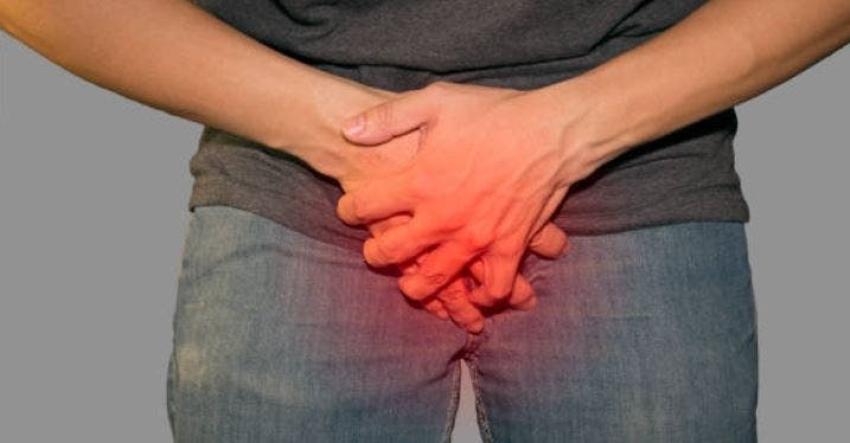 [FOTO] Examen de rayos x reveló que el pene de un hombre se está transformando en  hueso