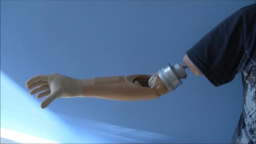 [VIDEO] La "mano biónica": El invento que promete revolucionar la tecnología de las prótesis