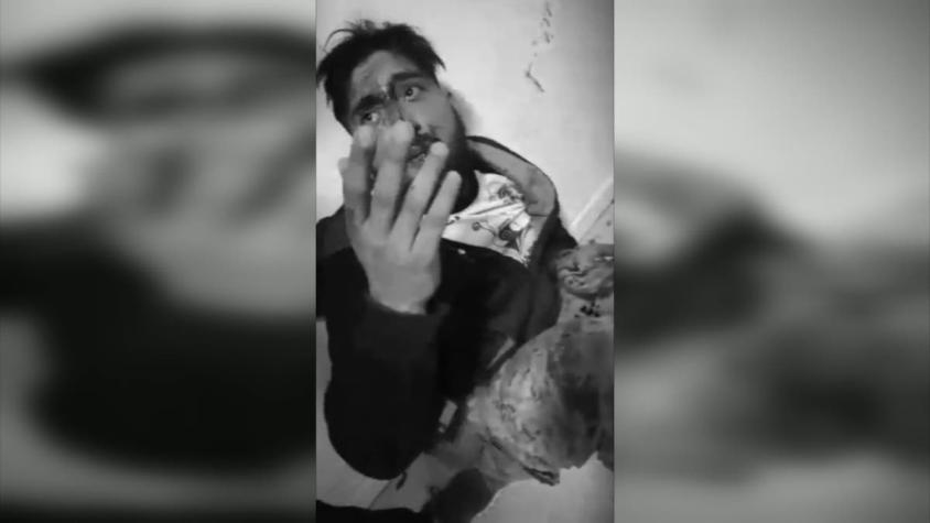 [VIDEO] Maltrato laboral: Trabajador venezolano acusa a su jefe de haberlo golpeado brutalmente