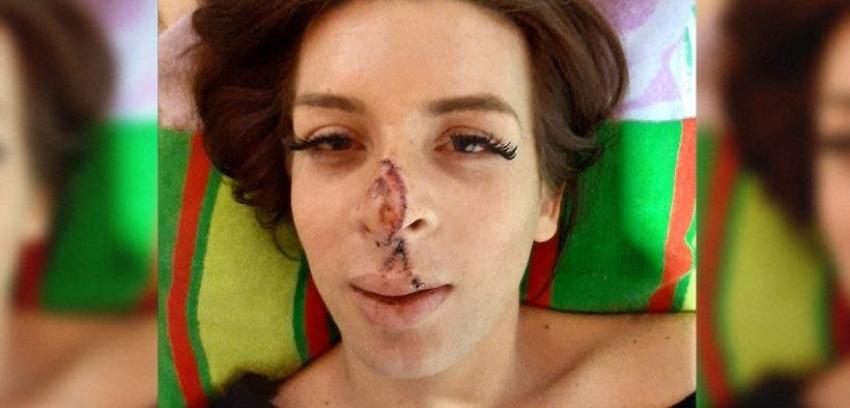 Denuncian brutal ataque a mujer trans en La Cisterna: 4 hombres se bajaron de un auto a golpearla
