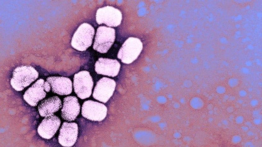 Viruela: ¿por qué guardan muestras de un virus que produce una de las enfermedades más letales?