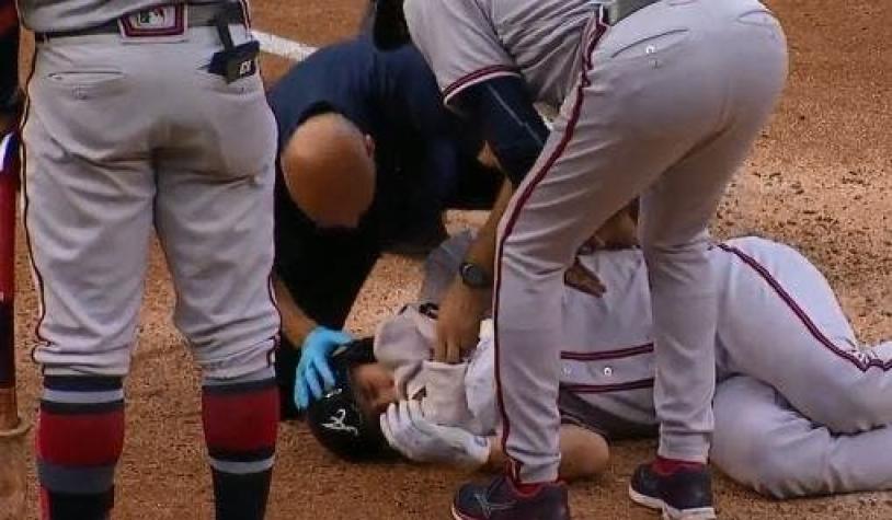 [VIDEO] Un jugador de baseball recibió un pelotazo en la cara y terminó con múltiples fracturas