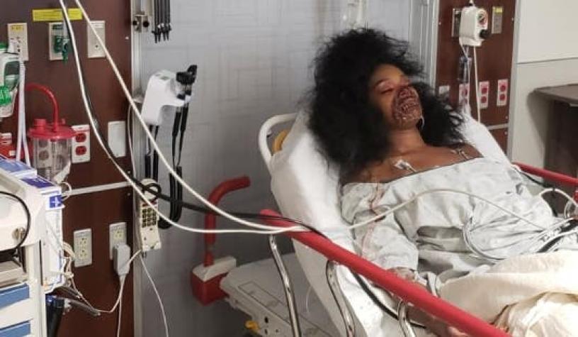 [FOTOS] Mujer con maquillaje "zombie" desata pánico en sala de emergencias de hospital