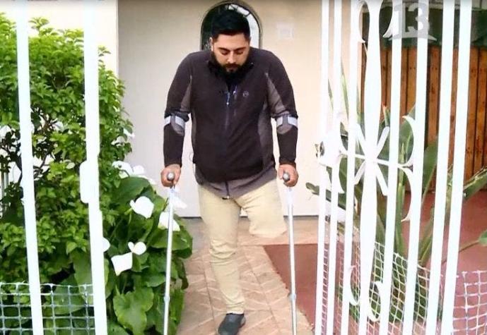 Rancagüino terminó con la pierna amputada luego de que le diagnosticaran erróneamente un esguince