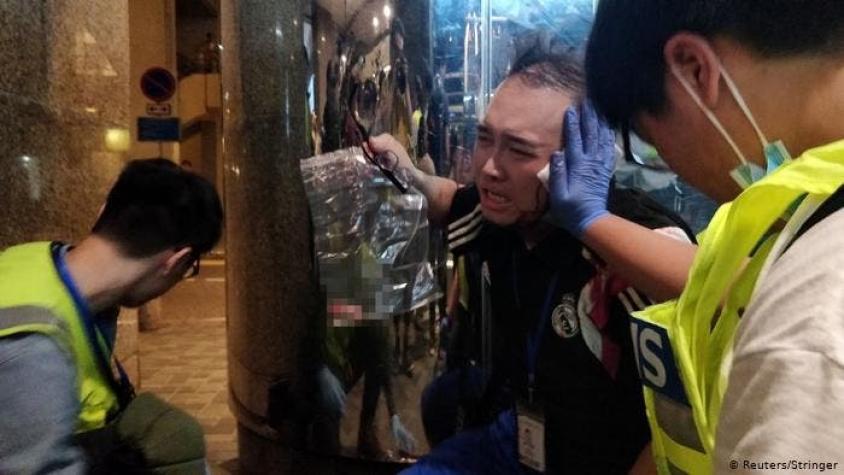 Hong Kong: ataque con cuchillo deja a dos personas con heridas graves en el marco de las protestas
