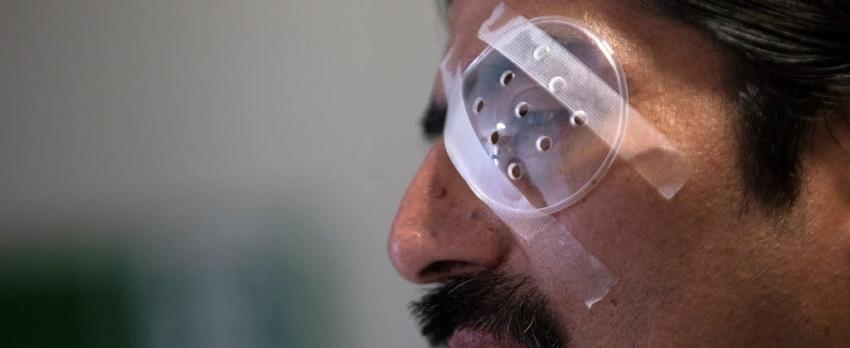 Sociedad Chilena de Oftalmología: 29 personas han sufrido pérdida total de visión
