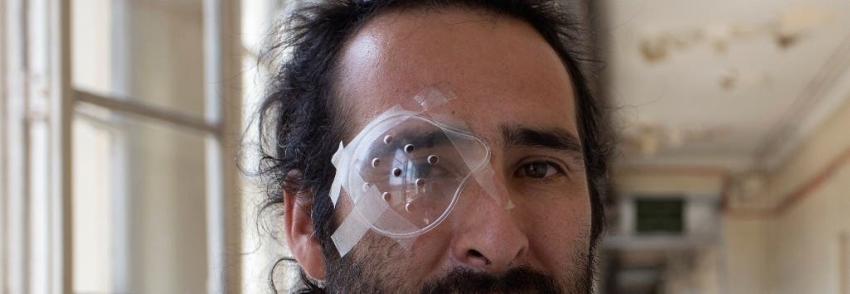 Sociedad Chilena de Oftalmología: casos de personas con traumas oculares ascienden a 234