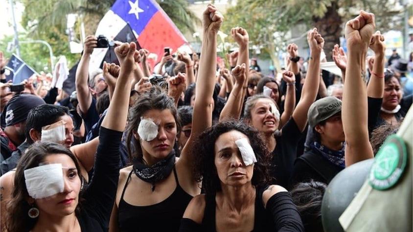 BBC | Por qué tantos manifestantes alrededor del mundo están sufriendo lesiones en los ojos