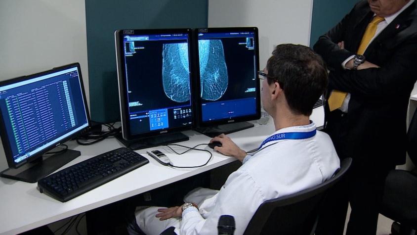 [VIDEO] Mamografías digitales con resultados en 72 horas