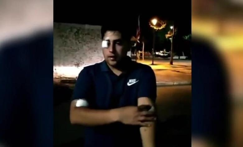 [VIDEO] Joven denuncia herida ocular tras recibir perdigones durante manifestación en La Granja