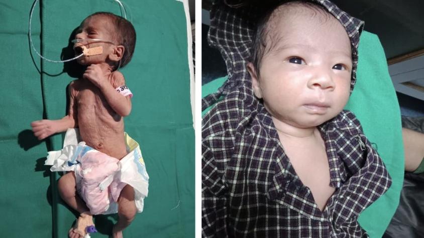 La conmovedora historia de una bebé prematura que fue enterrada viva en India y recuperó su salud