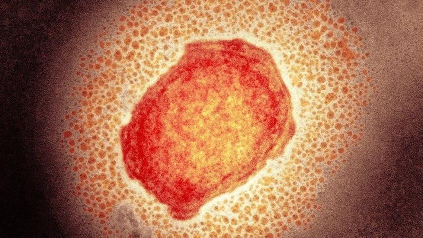 Qué es la "viruela de los monos", la rara infección que descubrieron en un paciente en Reino Unido