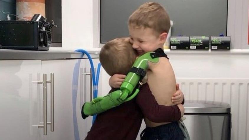 El tierno abrazo a su hermano menor de un niño de cinco tras recibir una prótesis de brazo
