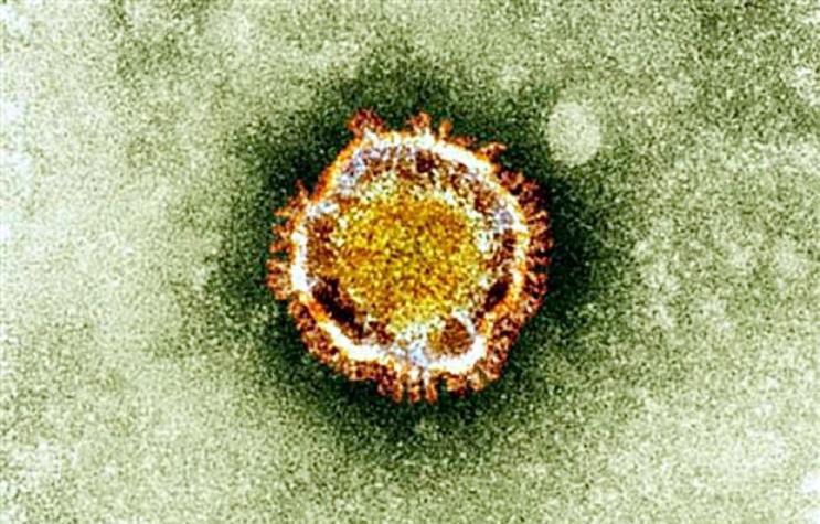 Confirman segundo paciente con "coronavirus chino" en EEUU: monitorean otros 63 casos